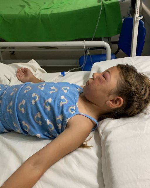 MY DAUGHTER WOKE UP FROM A COMA AFTER A BEE STING—BUT WHAT SHE SAID FIRST LEFT ME SHAKING