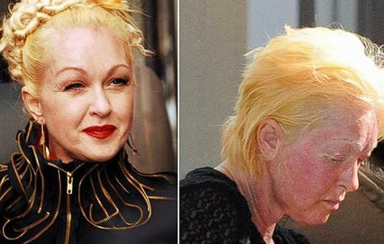 Challenging Times for Cyndi Lauper