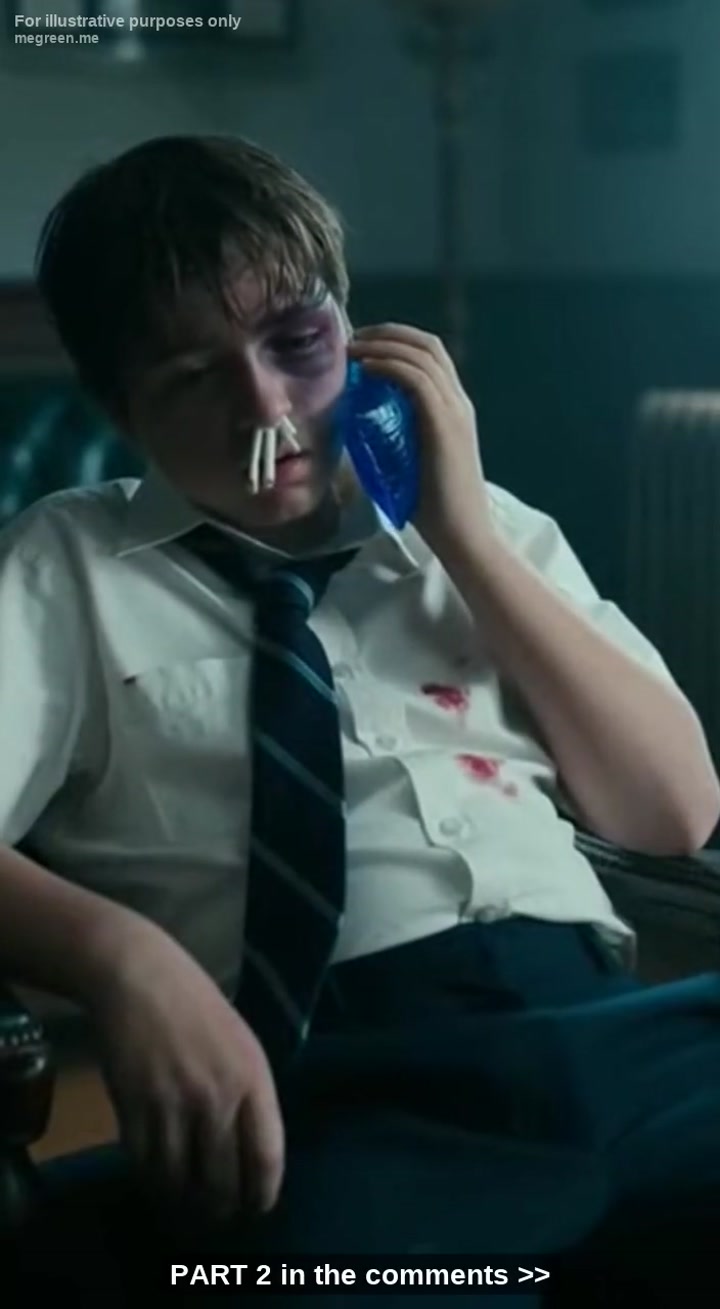 They Broke My Son’S Nose And Laughed